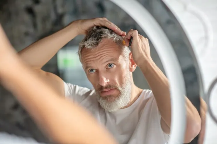 Implante de cabelo nas entradas